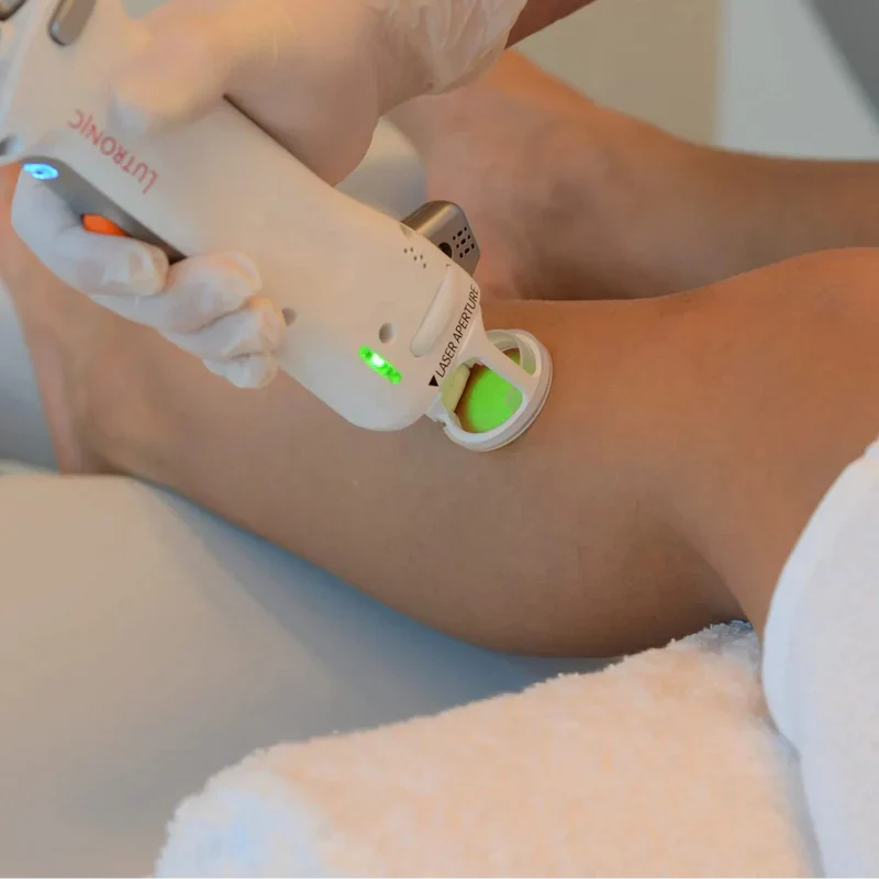 Épilation laser, soleil et bronzage à Aix-en-Provence